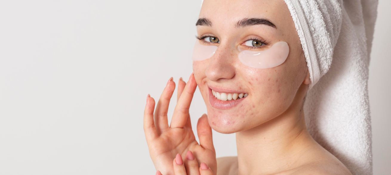 Cómo evitar brotes de acné: rutina y consejos para mantener la piel limpia