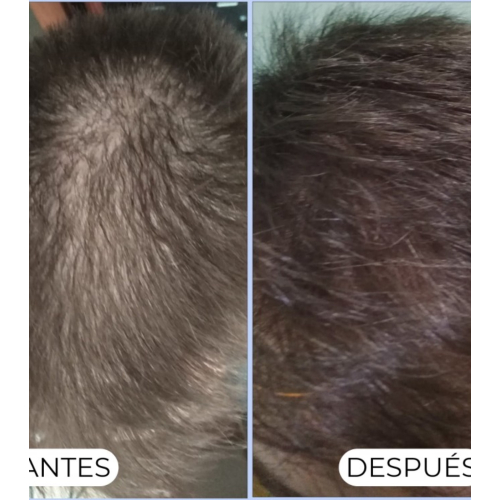 Alma Secret - Champú purificante Shikakai para pelo normal o graso