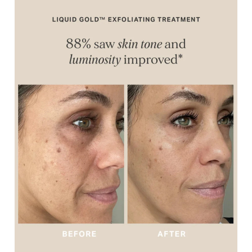 Alpha-H - Tratamiento exfoliante Liquid Gold 5% Ácido Glicólico