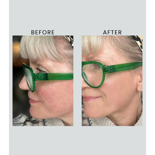 Altruist - Crema de día Dermatologist Anti-Redness & Pigmentation Light SPF50