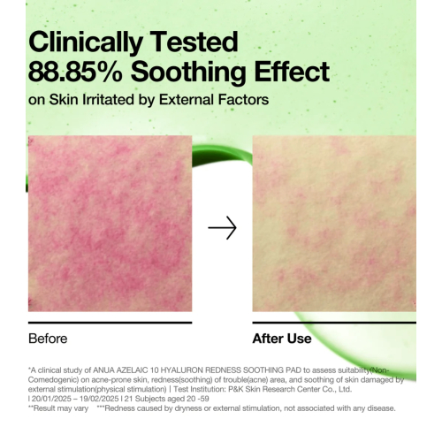 Anua - Almohadillas Azelaic 10 Hyaluron Redness Soothing formato pads