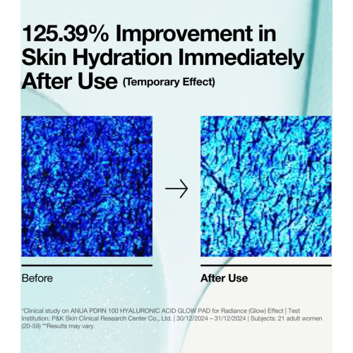 Anua - Almohadillas PDRN 100 Hyaluronic Acid Glow formato pads