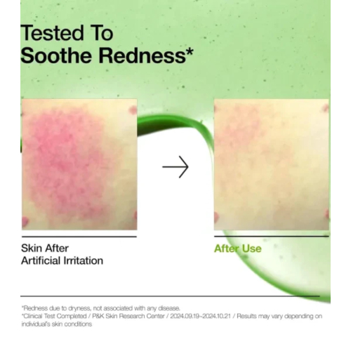 Anua - Sérum antiacné con ácido azelaico 10+ y ácido hialurónico