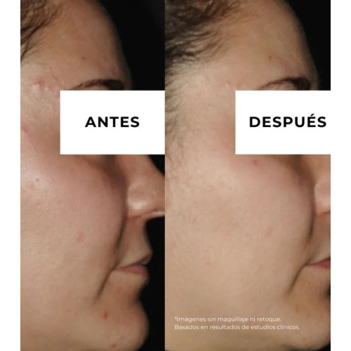 Arganour - Crema antiacné reductor de marcas Equilibrium - Pieles grasas con tendencia acneica