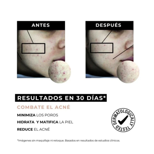 Arganour - Crema antiacné reductor de marcas Equilibrium - Pieles grasas con tendencia acneica