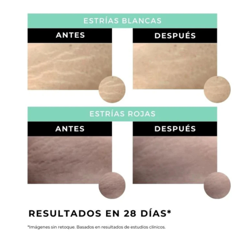 Arganour - Crema corporal antiestrías