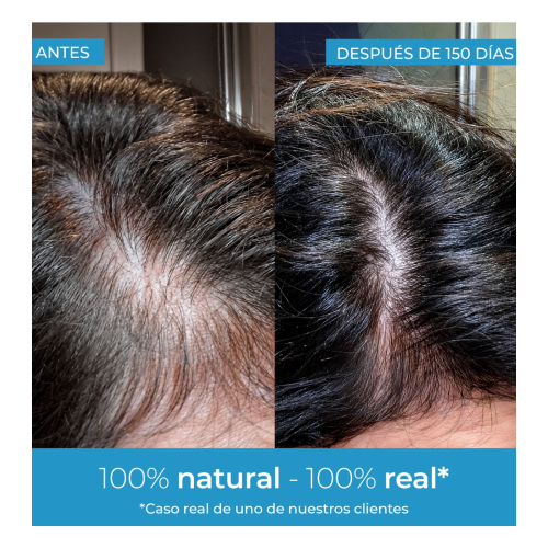 Arganour - Sérum fortalecedor del cabello Strength