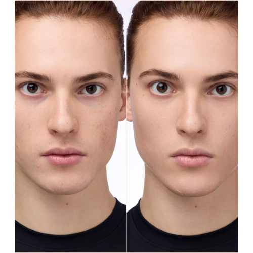 Catrice - Corrector Instant Bright - 032N