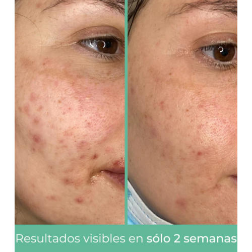 CR Cosmetics - *Purifying* - Crema facial seborreguladora