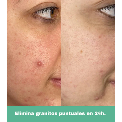 CR Cosmetics  - *Purifying* - Roll on anti-imperfecciones