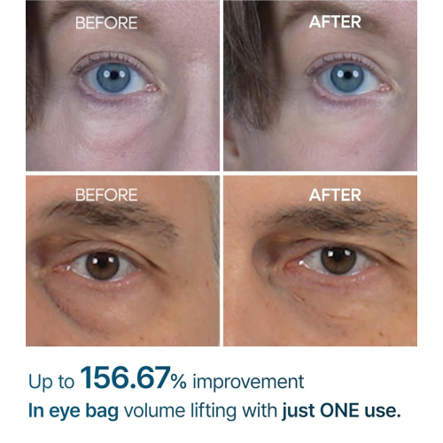 Dr.Melaxin - Crema para las ojeras Eyephalt