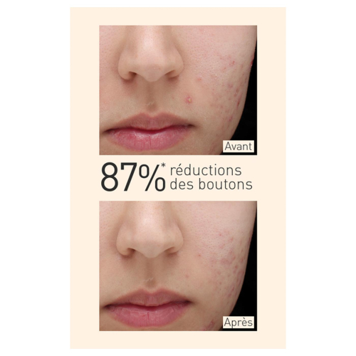 Embryolisse - Sérum matificante para pieles mixtas a grasas con extracto de Cúrcuma