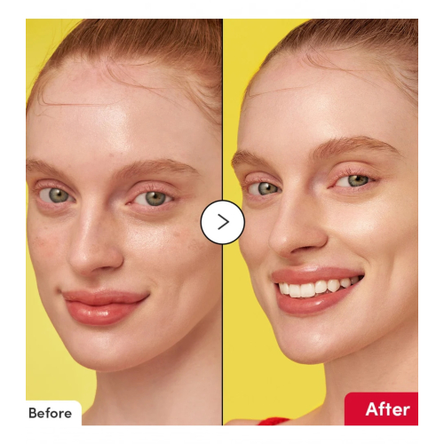 Eqqualberry - Sérum facial iluminador Vitamin