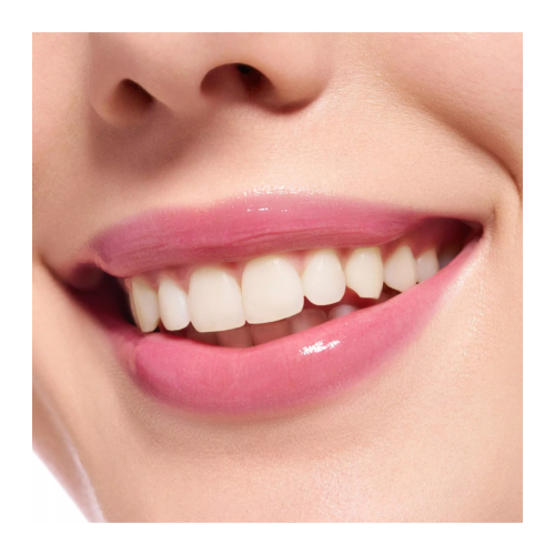 essence - Brillo de labios voluminizador Extreme Shine - 21: Pretty in Pink