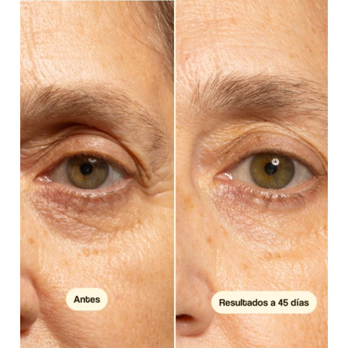 Freshly Cosmetics - Contorno de ojos anti-arrugas Exosome Well-Ageing
