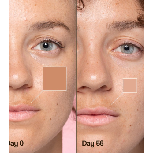 Freshly Cosmetics - Crema facial despigmentante Lotus Radiance Dark Spot Treatment