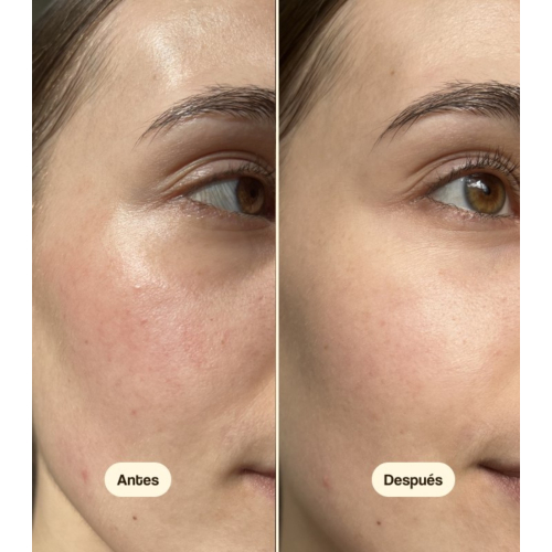 Freshly Cosmetics - Crema hidratante de día con Centella Asiática CICA Calm - Pieles secas y sensibles