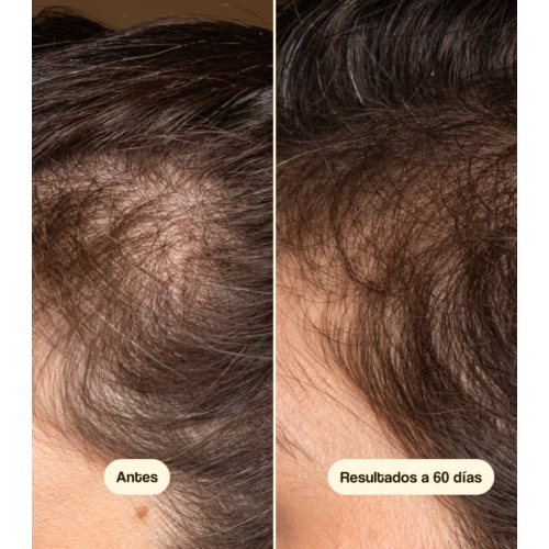 Freshly Cosmetics - Tratamiento anticaída para el cabello Hair Growth & Density