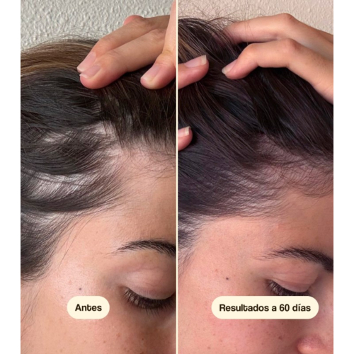 Freshly Cosmetics - Tratamiento anticaída para el cabello Hair Growth & Density