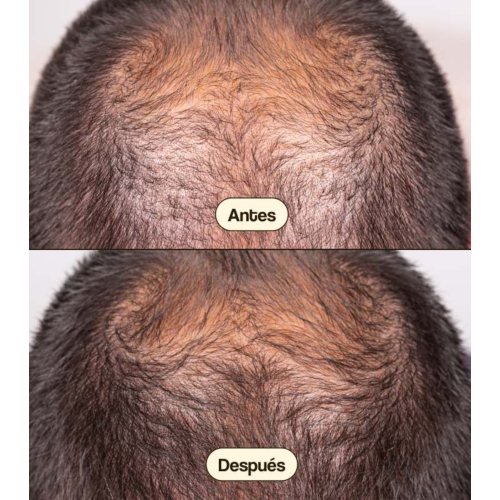 Freshly Cosmetics - Tratamiento anticaída para el cabello Hair Growth & Density