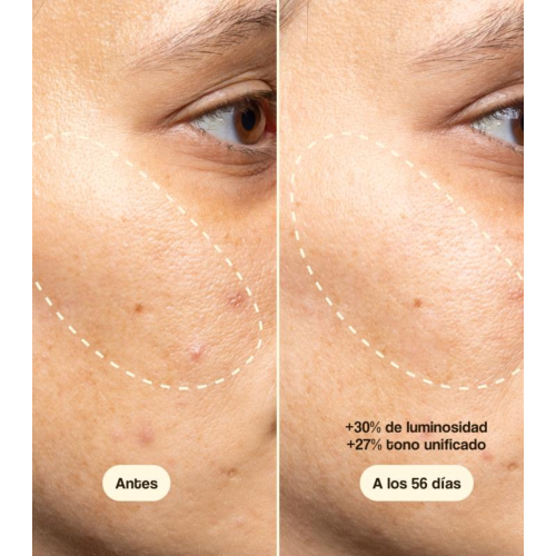 Freshly Cosmetics - Tratamiento facial con Vitamina C