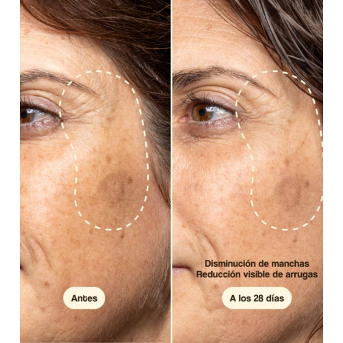 Freshly Cosmetics - Tratamiento facial con Vitamina C