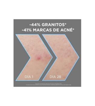 Garnier - *Skin Active* - Sérum anti-imperfecciones con Niacinamida, AHA, BHA y Carbón