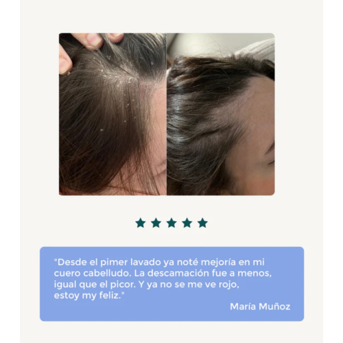 Green Cornerss - Champú de guisante - Cuero cabelludo sensible