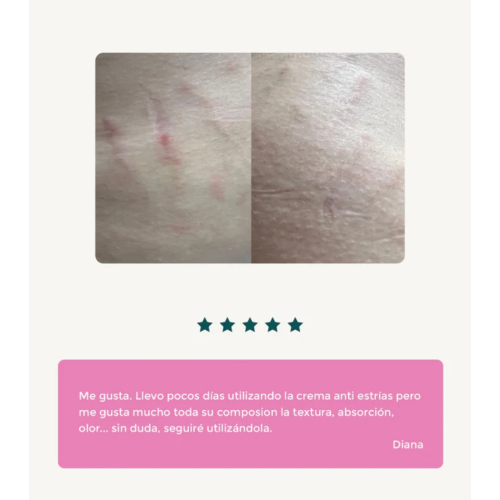 Green Cornerss - Crema anti-estrías con Sangre de Dragón