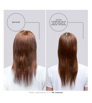 Grow Gorgeous - Sérum para el crecimiento del cabello para cabello fino y debilitado - Intense