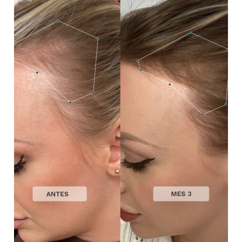 Hairburst - Vitaminas para el cabello Advance + Premium