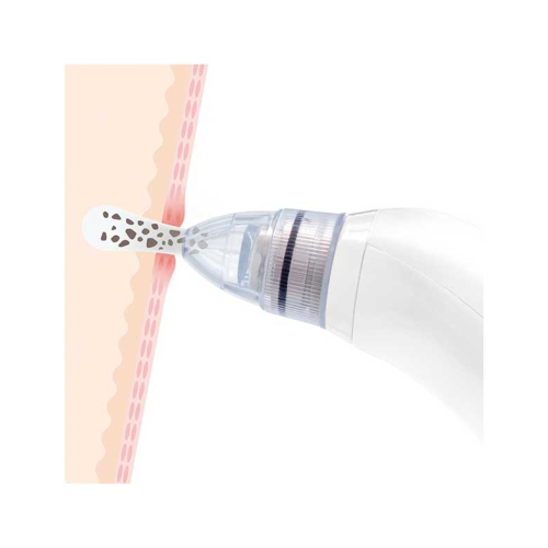 InnovaGoods - Limpiador facial eléctrico para puntos negros Pore·Off