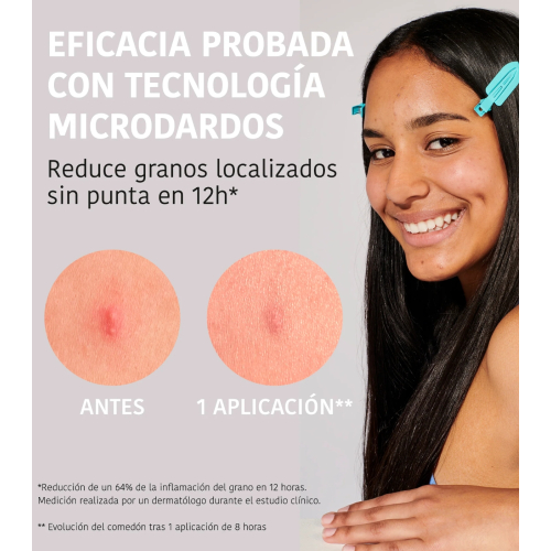 Iroha Nature - *Acne Prone Skin* - Parches para granos con ácido salicílico Microdarts