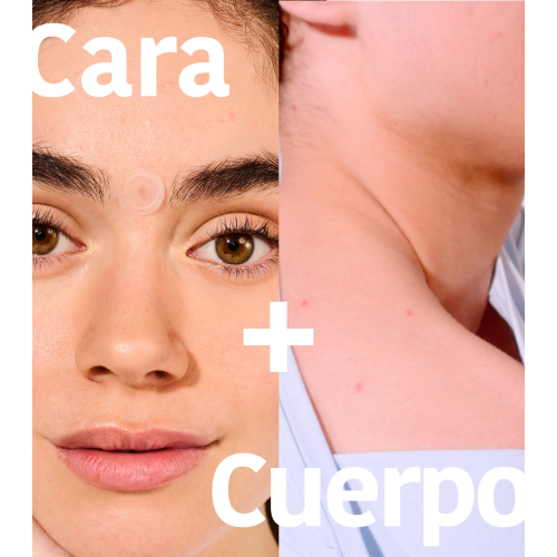 Iroha Nature - *Acne Prone Skin* - Parches para granos con ácido salicílico Microdarts