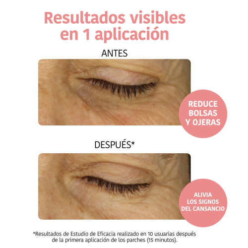 Iroha Nature - Parches anti-fatiga e iluminadores - Vitamina c, pepino y ácido hialurónico