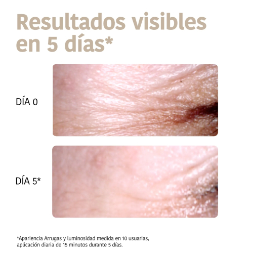 Iroha Nature - Parches Antiarrugas, Antibolsas, e Iluminadores Global Eye Care - Niacinamida, Cafeína y Péptidos