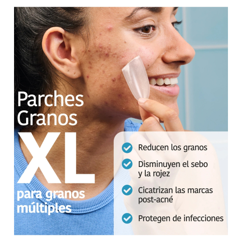 Iroha Nature - *Acne Prone Skin* - Parches para granos con ácido salicílico XL