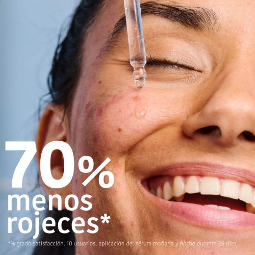 Iroha Nature - *Acne Prone Skin* - Sérum facial Prevent & Correct - Pieles acnéicas