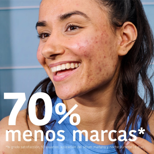 Iroha Nature - *Acne Prone Skin* - Sérum facial Prevent & Correct - Pieles acnéicas