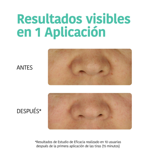 Iroha Nature - Tiras Detox Anti Puntos Negros - Carbón