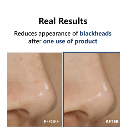 ISNtree - *Mugwort* - Sérum para unificar tono Hyper Acid 4 AHA BHA PHA LHA 30