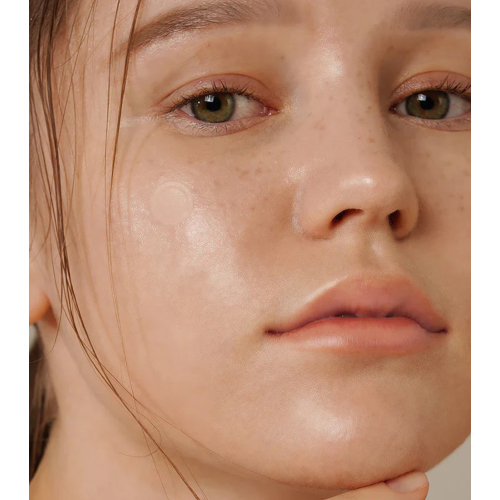 ISNtree - Parches anti-imperfecciones Onion Newpair Basic - 24ud