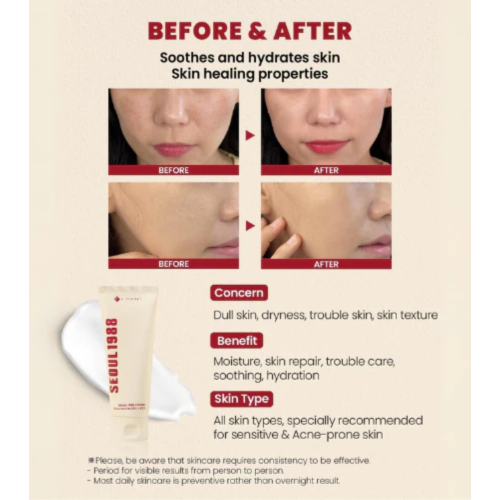 K-Secret - *Seoul 1988* - Crema facial Snail Mucin 93% + Rice