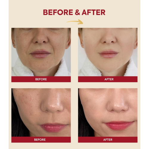 K-Secret - *Seoul 1988* - Esencia Snail Mucin 97% + Rice