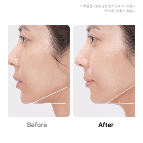 Medicube - *Age-R* - Dispositivo avanzado de cuidado facial Booster Pro Ex