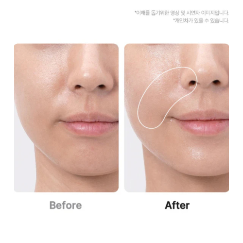 Medicube - *Age-R* - Dispositivo avanzado de cuidado facial Booster Pro Ex - Pink