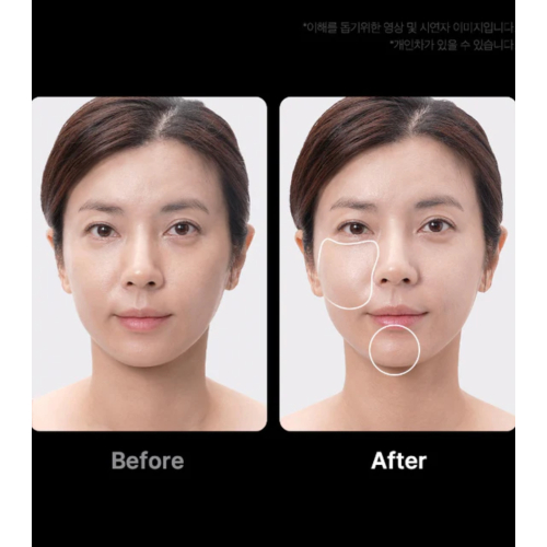 Medicube - *Age-R* - Dispositivo avanzado de cuidado facial Booster Pro Ex - Pink