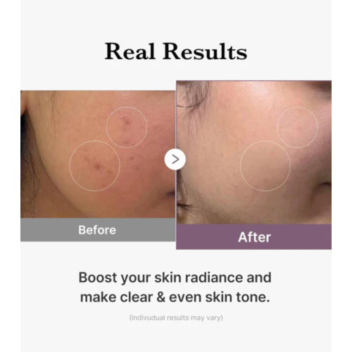 Medicube - *Age-R* - Tónico hidratante Glutathione Glow Toner