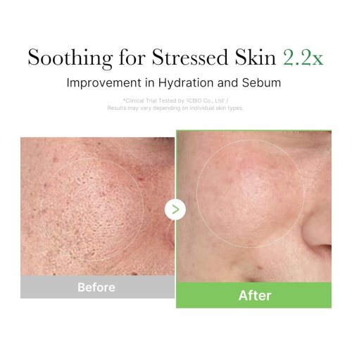 Medicube - *Cica* - Crema facial reparadora Exosome Cica Cream