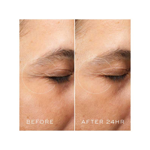 Medik8 - *Crystal Retinal* - Crema antiedad para contorno de ojos con Retinal y Vitamina A Ceramide Eye 6